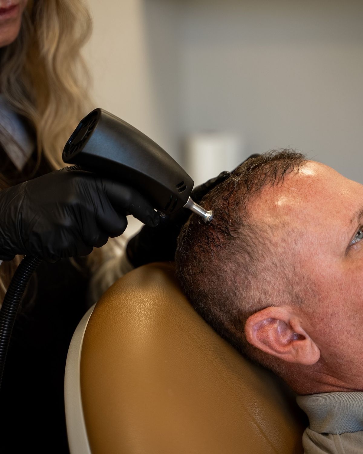 The Alma TED needle-free hair restoration device at EliteMD Aesthetics